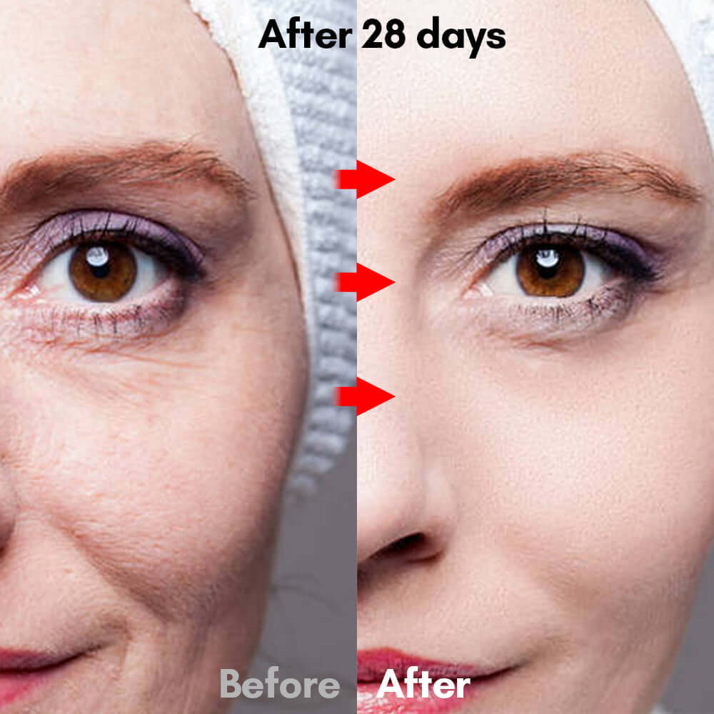 LED Lys-maske til hudpleje