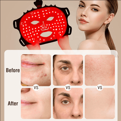 LED Lys-maske til hudpleje